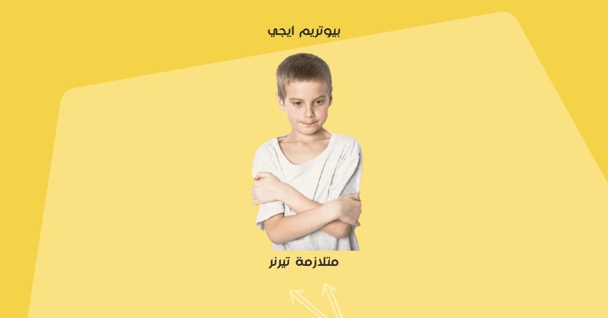 متلازمة تيرنر